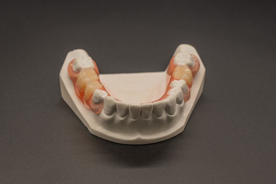 Melting Temp 287°C Denture Material Denture Flexible Acrylic Partial ...