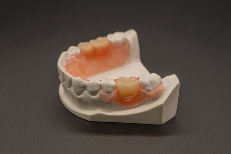 A white dental model displaying a pink partial denture with replacement teeth.